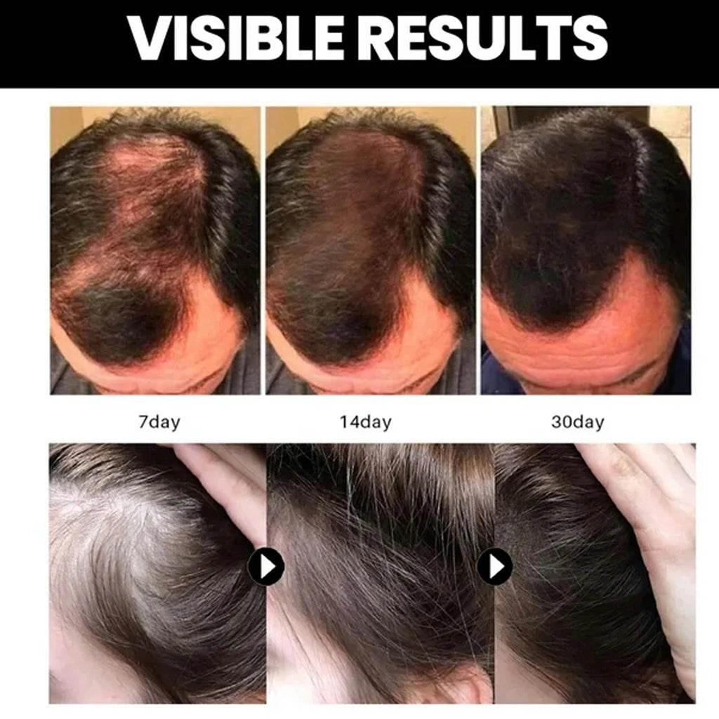 Hair Growth & Nourishing Oil
